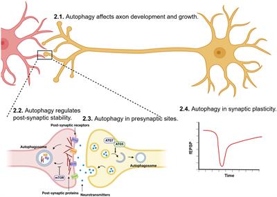 Epigenetic regulation of autophagy in neuroinflammation and synaptic plasticity